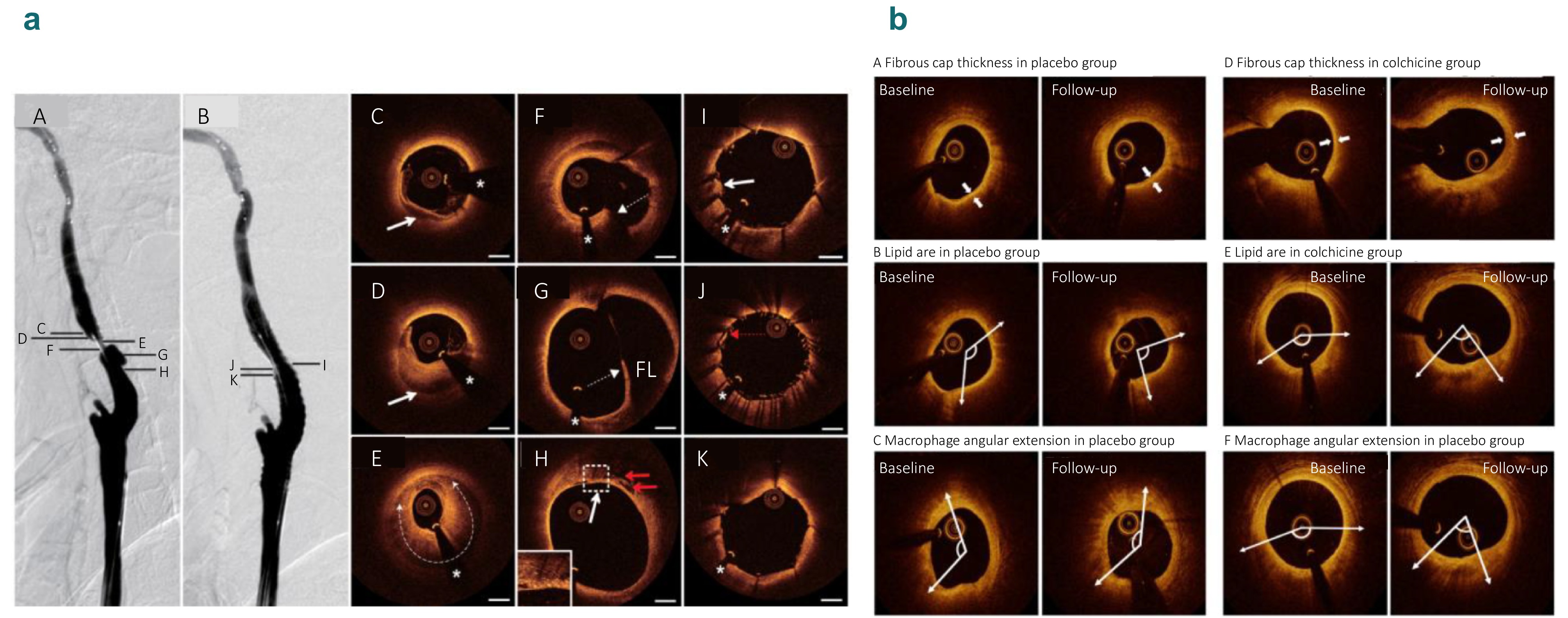 同 Advances in optical coherence tomography for intelligent diagnosis